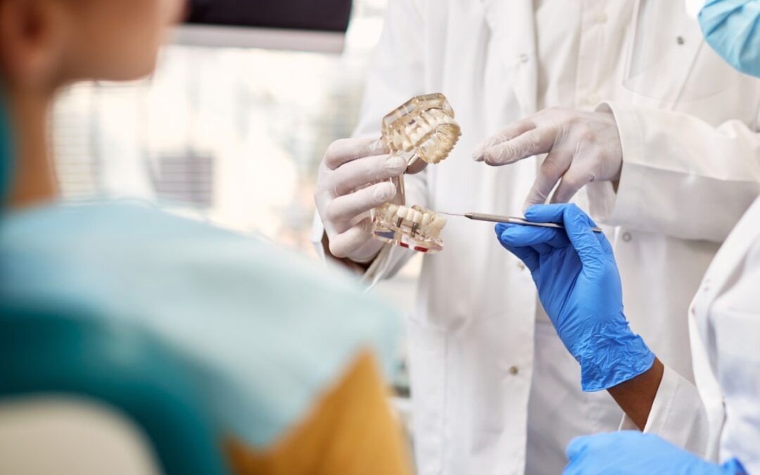 The Benefits of Choosing Implants for Broken Teeth