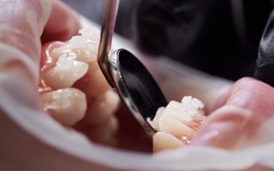 Unleash a Radiant Smile with Trusted Cosmetic Dentists