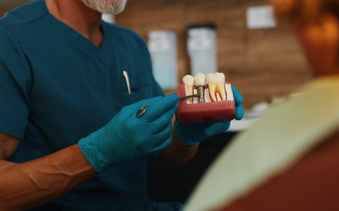 Can You Get an Implant if You Grind Your Teeth?