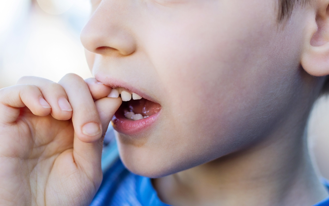 Can A Loose Tooth Tighten Up Again